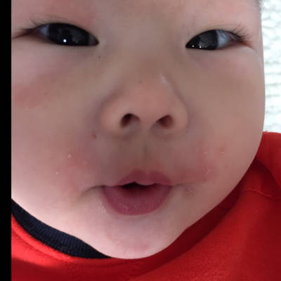 宝宝6个半月了,这两天嘴巴四周很红,网上查了