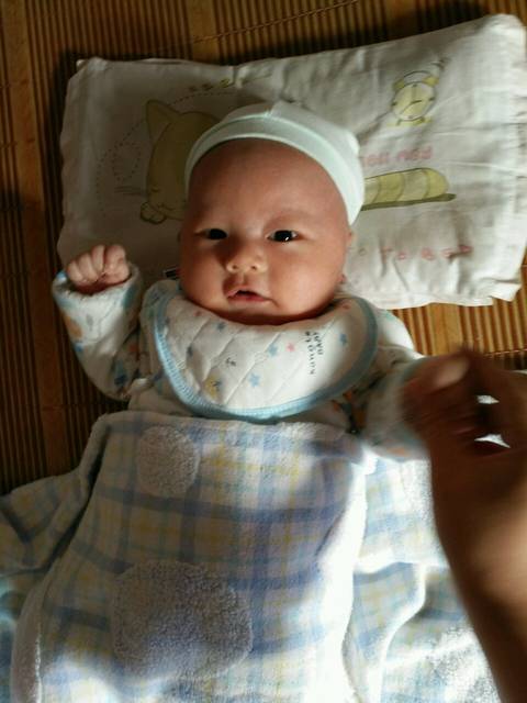 母乳性黄疸_请问母乳性黄疸怎么处理,喂养好?