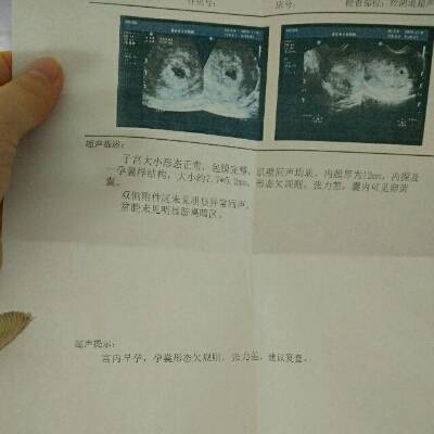 10月3日来月经,10月16日排卵,今天11月6号做