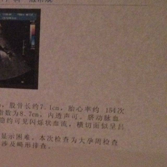 计算体重_有没有会计算宝宝体重的 我的大根多