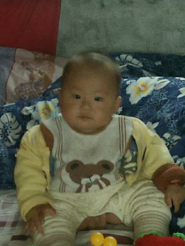 习惯性斜颈_有没有哪位宝宝有习惯性斜颈啊,有