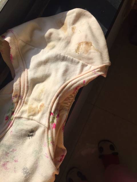 孕初期,褐色分泌物。粉红色血。有图慎入_孕五