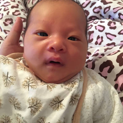 未满月宝宝斗鸡眼正常吗