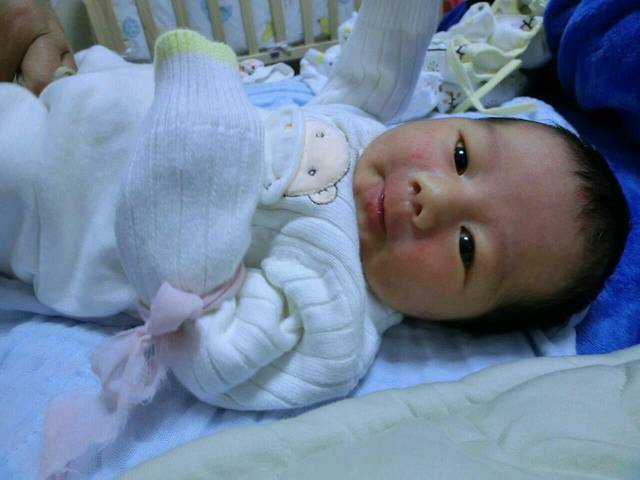 刚出生几天的宝宝脸上长了红点点,怎么办_初来