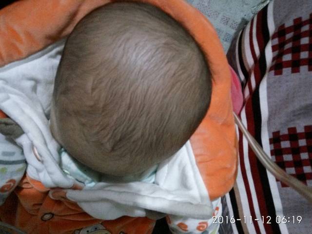 宝宝左后脑勺睡扁了怎么办?_出院回家我发展