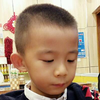 我家男宝4周岁另9个月,头上卤门有道楞,图片头