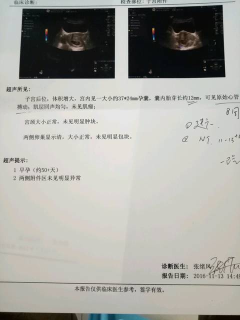 宝妈们,怀孕看看是女孩_帮忙59天做的b超,二太女生黄好吗图片