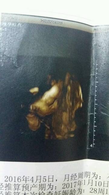 四维顺利通过,宝贝侧脸照_二十八周查的四维,