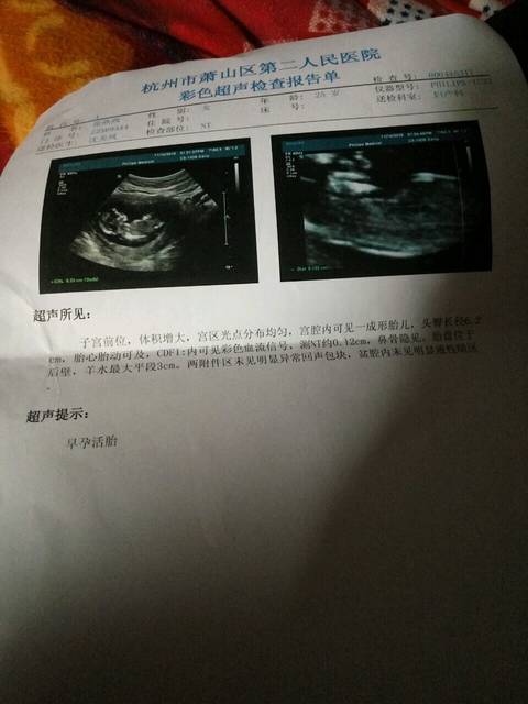 nt顺利通过_胎儿已成型,不知道是男是女,只求能