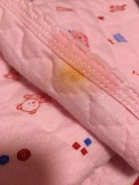 为什么刚出生三天男宝宝尿尿有粉红色东西?_