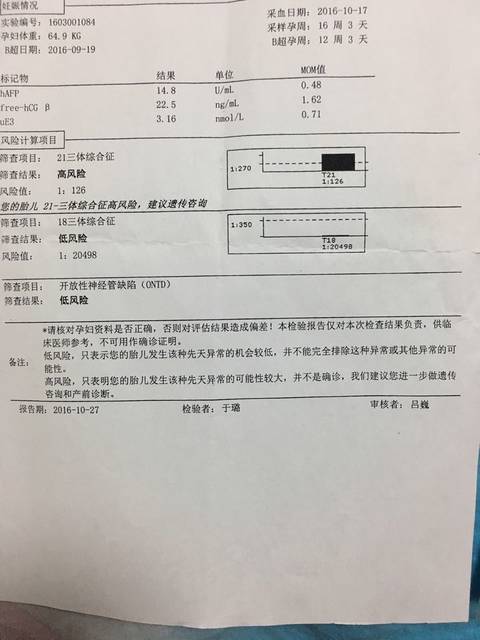 唐筛高危 无创DNA低风险安全通过(有图)