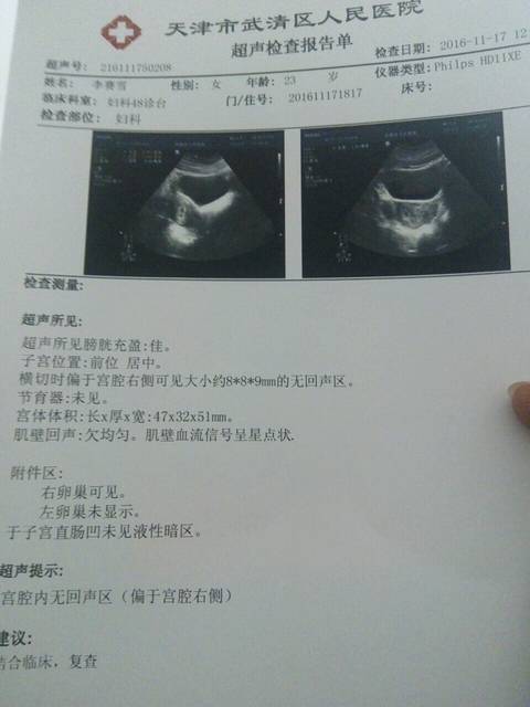 希望一切安好_怀孕五周多, 肚子一侧总感觉不