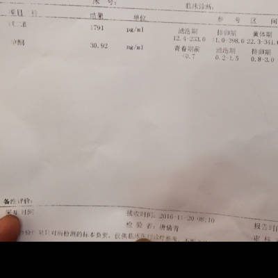 雌二醇1791,孕酮30.92正常吗?孕50天