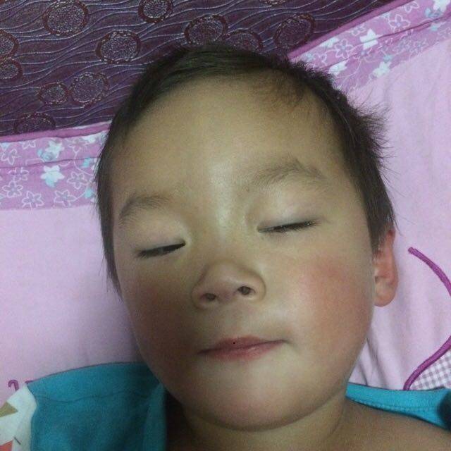 反复发烧 愁死人_不咳嗽 也不流鼻涕 吃了感冒