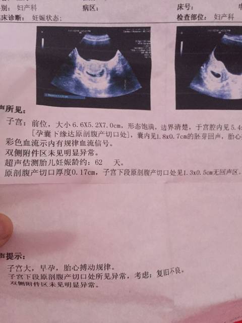 不想放弃宝宝_两年前剖腹产,现在怀孕9周!原剖