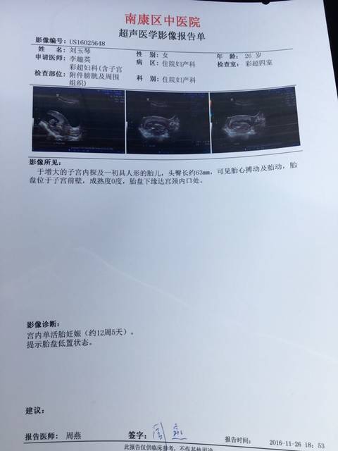 怀孕3个月,胎盘位置低_怀孕3个月,医院B超检查