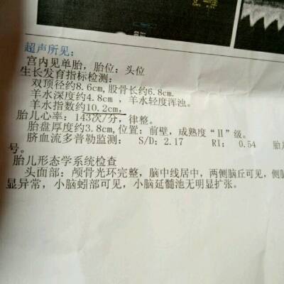 帮忙看下羊水,轻度浑浊