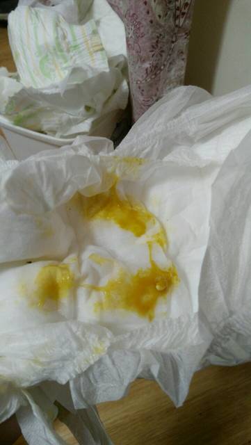 宝宝这样算不算拉肚子,能打疫苗吗。急!_宝宝