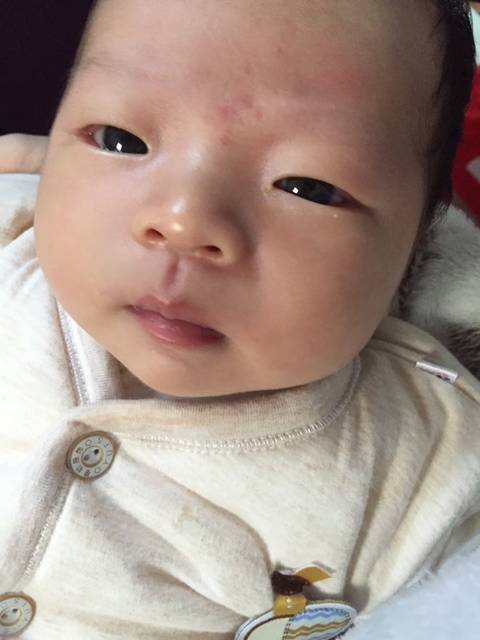 宝宝_宝宝左眼睛下皮有个小白豆这是什么呢?
