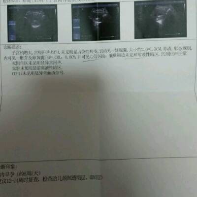 怀孕六周,体内流出黑褐色分泌物。去医院B超检