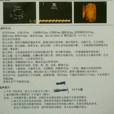 一号的时候做了四维彩超 医生说侧脑室数值偏