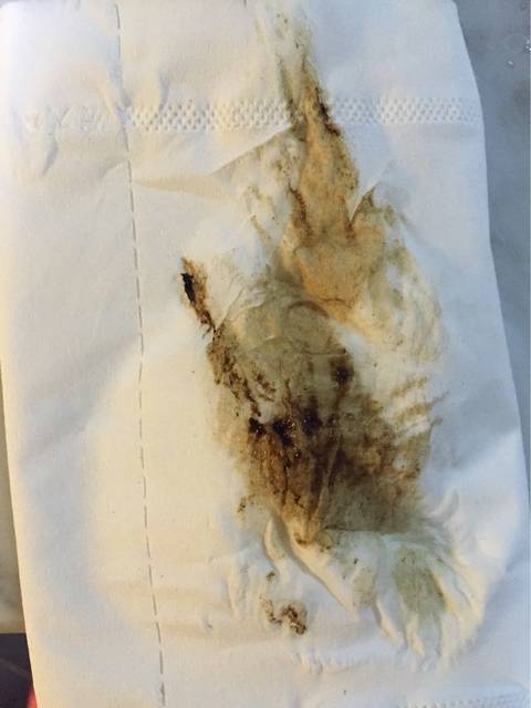 孕34天下面流褐色分泌物,伴小腹坠胀,怎么办呀