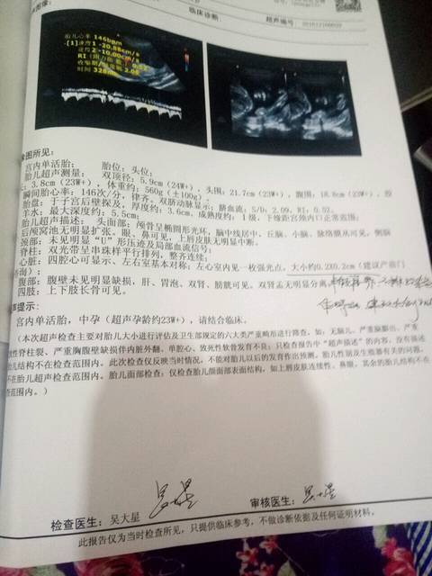 亲,帮忙看看_怀孕22周多,今天查了四维彩超显