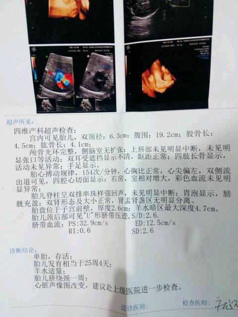 请大家给我看看这张四维彩超胎儿心脏问题大不?