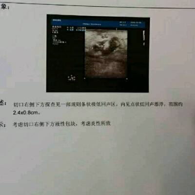 伤口旁出现红 肿,第二天去医院医生诊断脂肪液