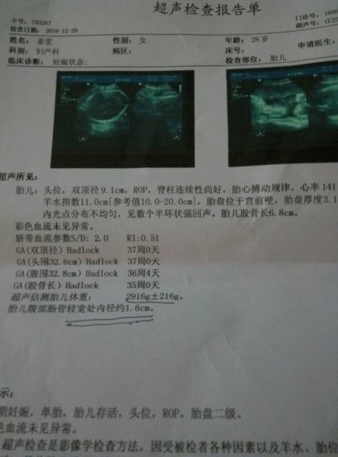 ,胎儿腹部肠管扩张_才做的b超,胎儿腹部肠管宽