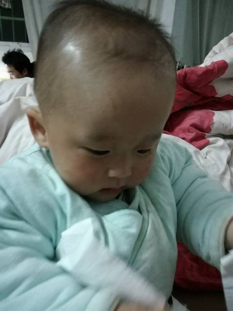 宝宝天灵盖鼓起来的!_宝宝八个月,天灵盖还没