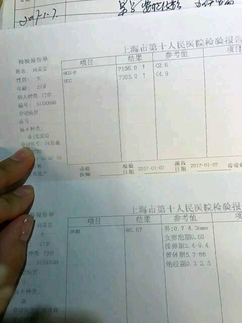 忐忑不安图片_忐忑不安是什么意思