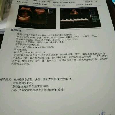 38周+2, 入盆了,胎盘成熟度二级 多久会生?看得