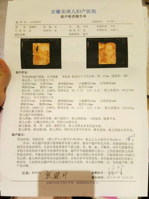 双羊膜囊,单胎盘是同卵还是异卵双胞胎_在8周