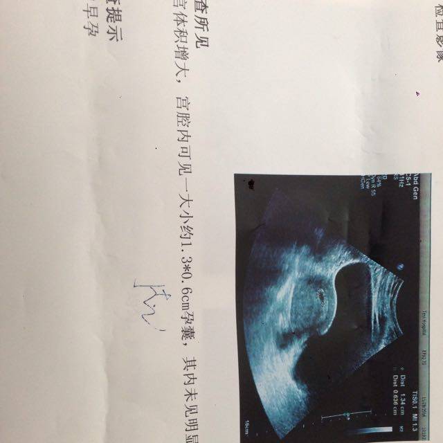 懂的帮我看下女孩图片芭蕾万分感谢_我的片子跳舞女生男孩头胎图片