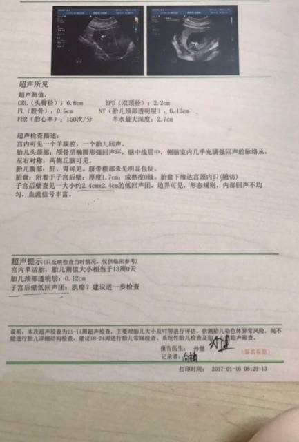 12+3 NT归来!_NT正常 但是胎儿在子宫后壁 同