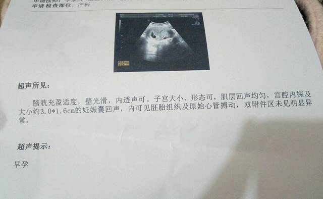 怀孕第一次b超 48天测胎芽胎心 一切正常 开心