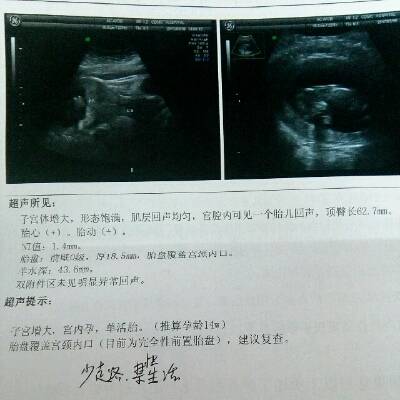 完全性前置胎盘怎么办