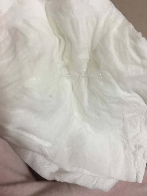 排卵期拦截,有信息白带小米同房图片