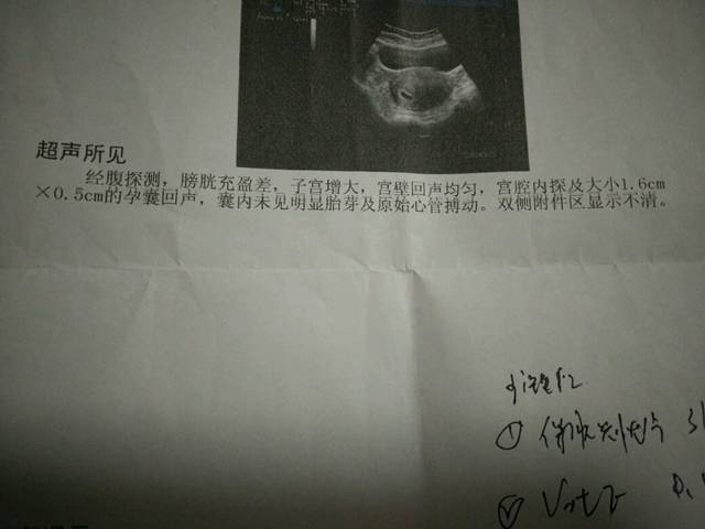 有经验的宝妈给看看.拜托_我怀孕8周去做的彩