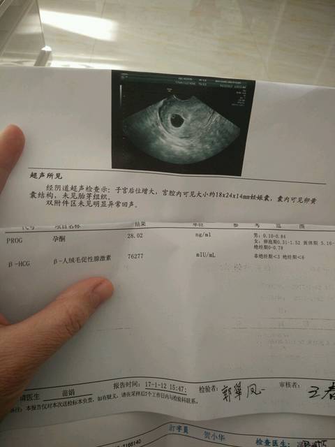 不知道怀孕,喝酒了怎么办?_12月1号末次月经