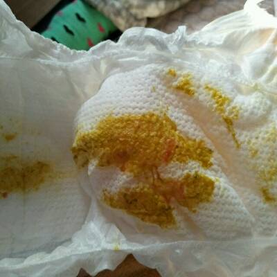 四个半月宝宝,这两天总是哭闹,不知道是因为长