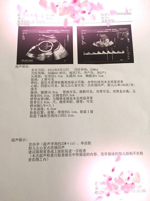 B超单看老大的帮帮忙_男女是个手指,这胎不女孩纤长女生的图片