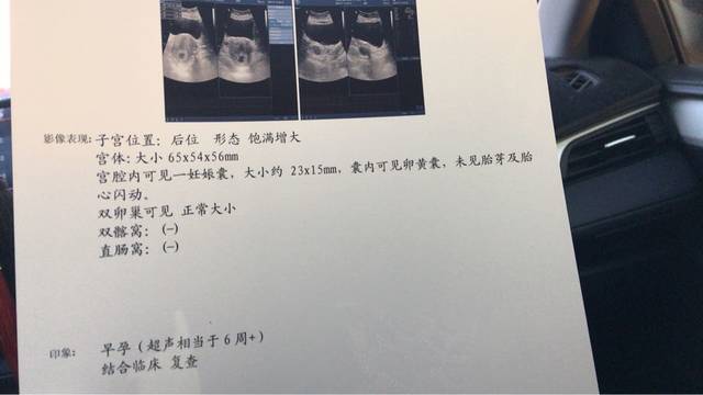 怀孕6周未见胎心胎芽正常吗_怀孕6周未见胎心