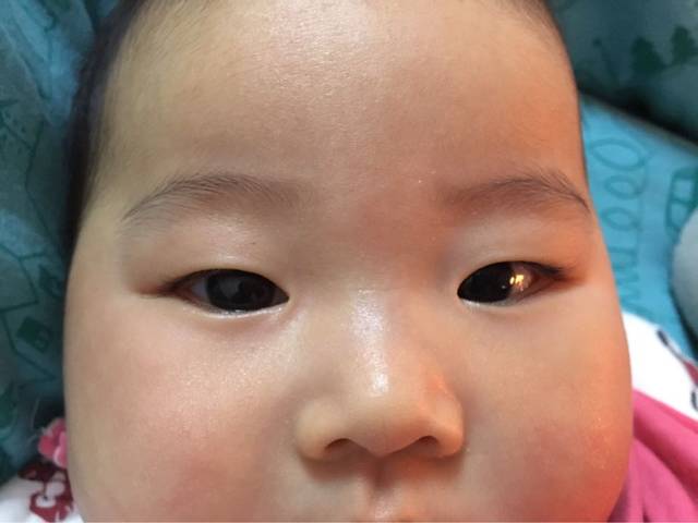 请问宝宝有双眼皮线嘛?_请问宝宝有双眼皮线