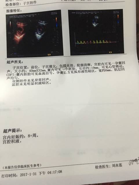 有哪位宝妈跟我一样_怀孕9周孕囊后方见弧形液性暗区应该怎么办_宝宝树