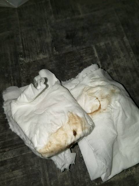 _怀孕初期分泌物,有经验帮看看_宝宝树