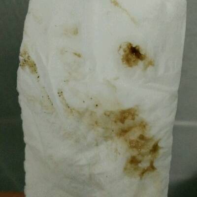 是不是先兆性流产?在线等