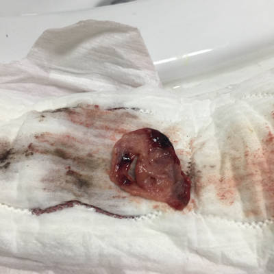 您好 如果我连续服用优思明27天,就在第27天时