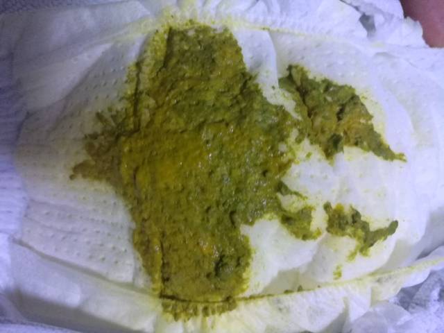 33天宝宝,黄绿色大便是否正常。_33天宝宝,大